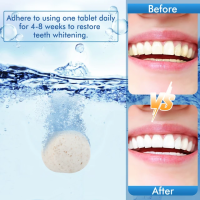 Teeth Whitening, Oral Cleaning, Efficient Care, Whitening Tablets